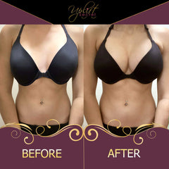 Uplift Secret Silicone Bra Inserts - Clear Gel Push Up Breast Pads - Bra Padding Bust Enhancer Medium