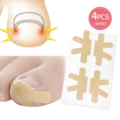 Ingrown Toenail Corrector Stickers