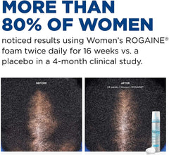 Rogaine 5% Minoxidil Foam, Topical Once-A-Day Hair Loss Treatment for Women to Regrow Fuller, Thicker Hair, Unscented, 2-Month Supply, 2.11 oz Natural 2.11 Ounce (Pack of 1)